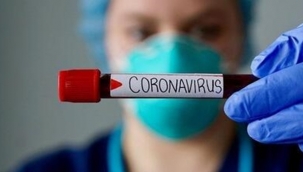 Bugünkü vaka sayısı 1.309! 22 Ağustos 2020 güncel koronavirüs tablosu