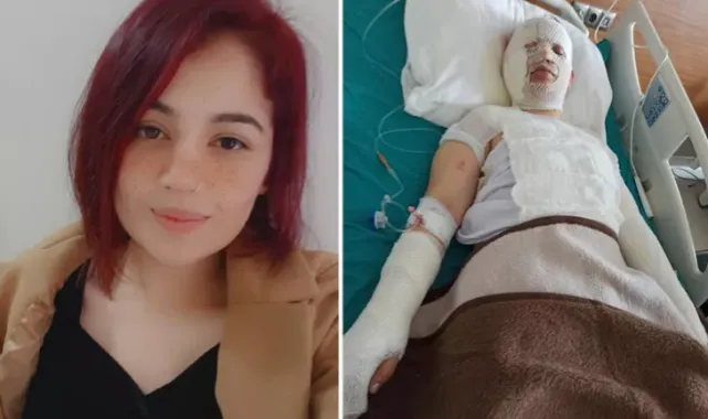 Depremzede eski eşini kaynar su ile yaktı, 'artçı sarsıntı nedeniyle oldu' dedi!