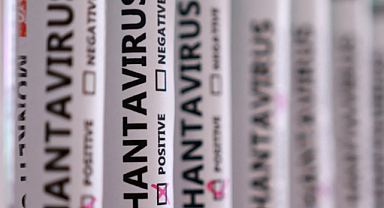 Türkiye’de Hantavirüs İddialarına Bakanlıktan Açıklama Geldi