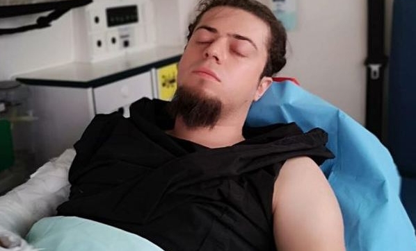 Kobra Yılanı Tarafından Isırılan Sihirbaz Aref'in Hayatta Kalması Bu Panzehire Bağlı