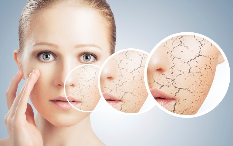 Kuru Ciltler İçin Doğal Maskeler