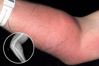 18 Ay Boyunca Koluna Sperm Enjekte Etti! Sonuç Çok Şaşırtıcı Oldu