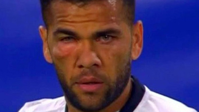 Dani Alves Ne Hale Geldi!