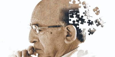 Alzheimer’a Erken Tanı Konulabilecek