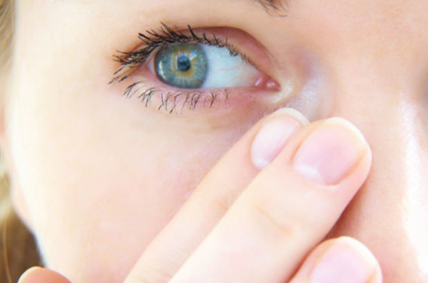 Alerjik Göz İltihabına Dikkat!