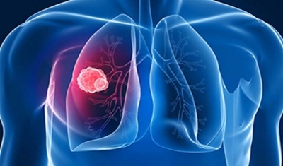 Dikkat! Metrobüse Binerken Verem Olmayın!