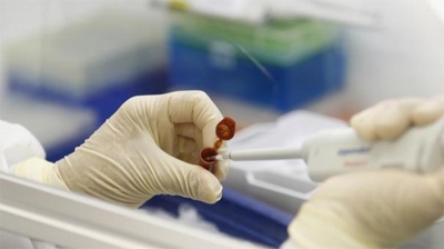 Domuz Gribi, Myanmar'da 3 Cana Mal Oldu