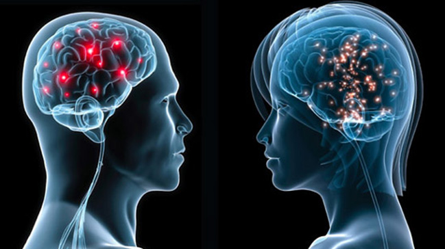 Beyin Kıvrımları ile Şizofreni Teşhisi