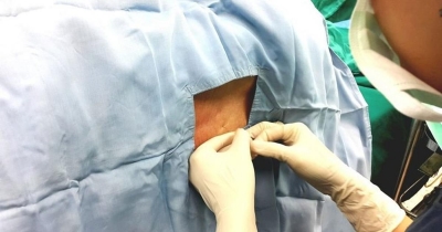 Felçli Hastalar, Sinir Nakli İle Umutlandı