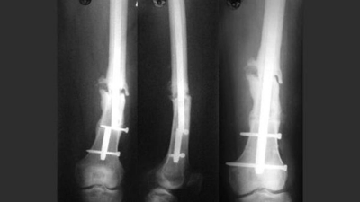 Hastanelerdeki Sorumsuzluk Yaşamları Karartıyor