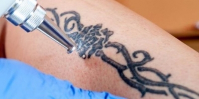 Kalıcı Dövmesi Olanlara Korkutan Uyarı!