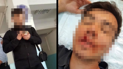 Muğla’da Bir Öğretmen Trafikte Kavga Ettiği Üniversite Öğrencisini Beyzbol Sopasıyla Döverek Hastanelik Etti!