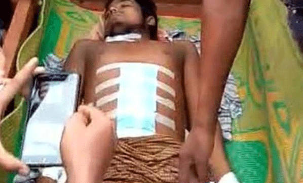 Şok Olay! Hastanede İç Organları Çalındı