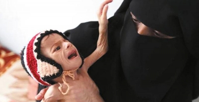 Yemen'de, Bir Ay İçerisinde 600 Kişi Koleradan Hayatını Kaybetti